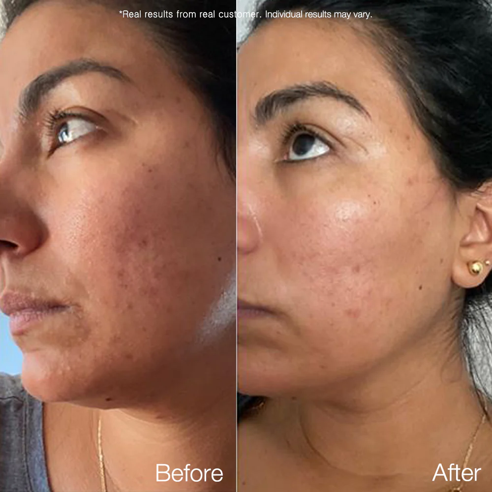 Carrotene Trouble-Free Kit (with FREE Minis!) - Image 5