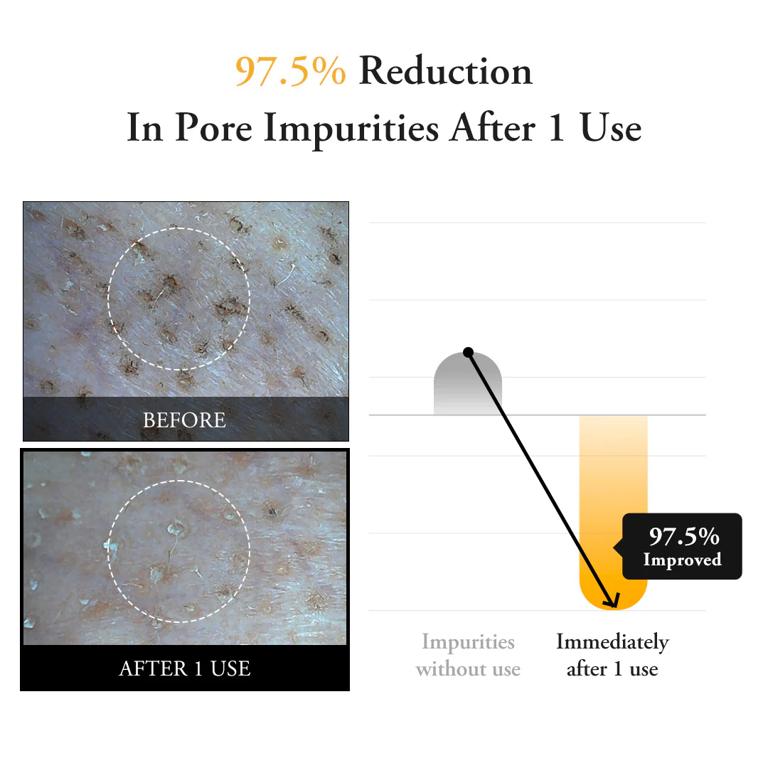 Calendula Peel Off Mask - Image 5