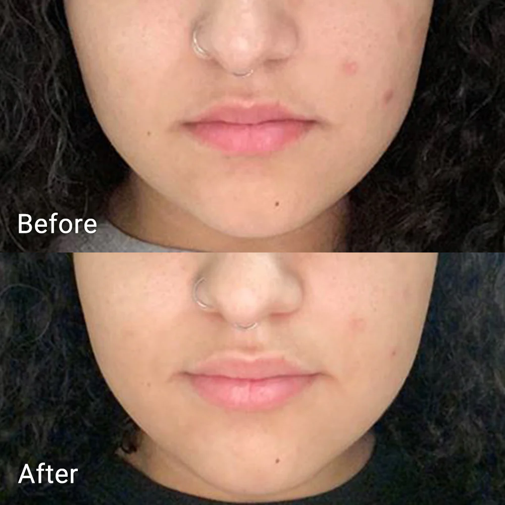 Calendula Peel Off Mask - Image 8